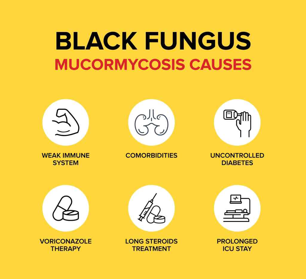 'Black Fungus' Infection, Causes, Symptoms & Treatment | Ketto